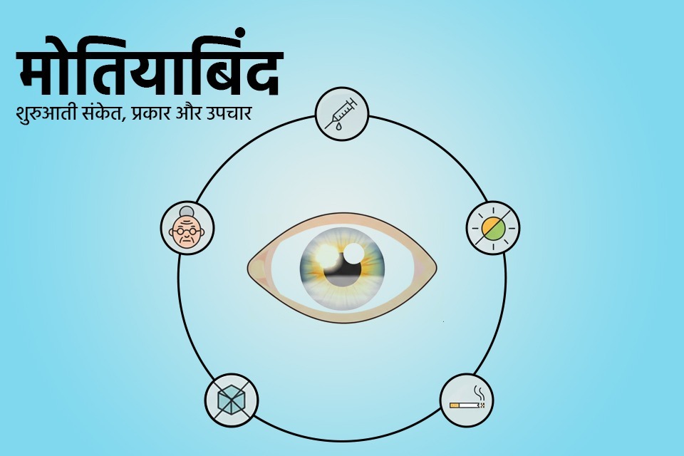 best eye hospital in Lucknow for Ocular Surface Infections , Susanjeevani Hospital